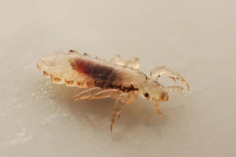 Has Your Child Been Infected With Head Louse? Here’s the Facts and Treatments